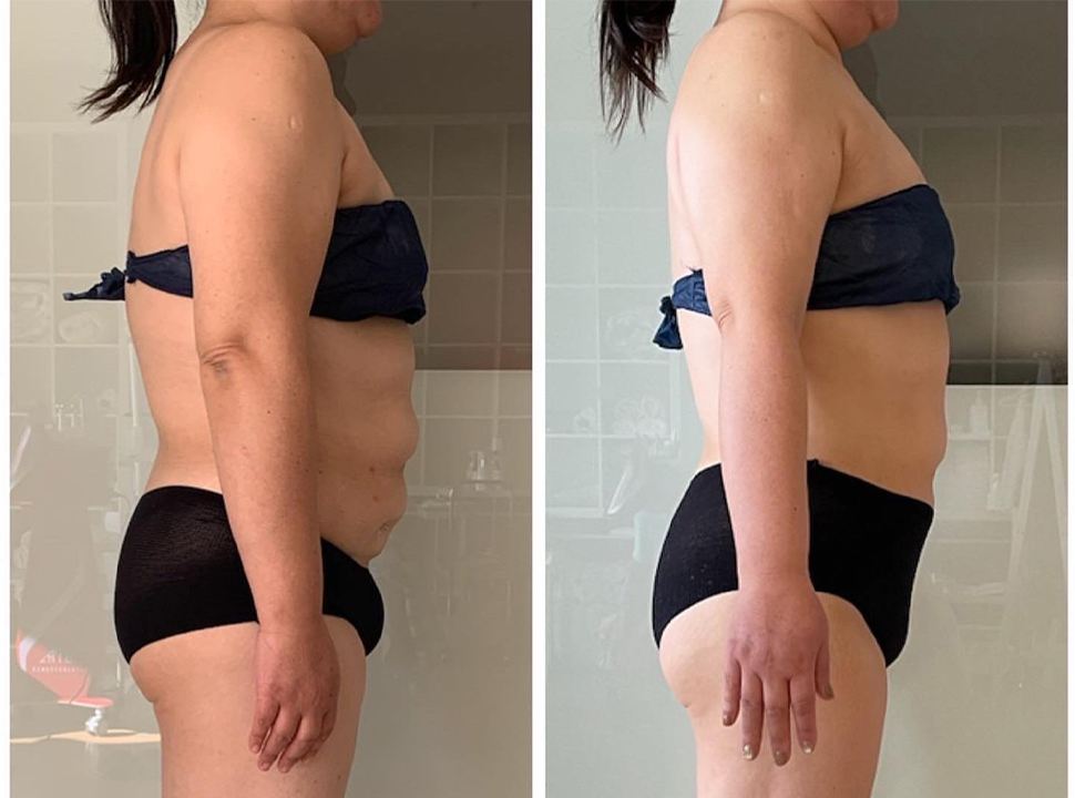 ウルトランスフォーマー