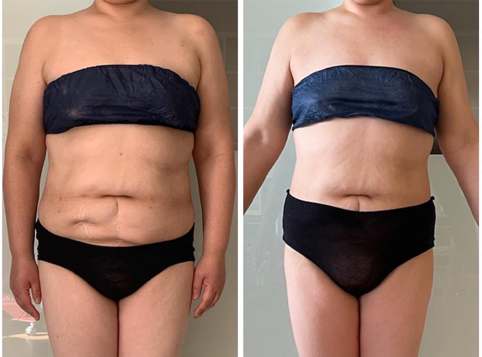 ウルトランスフォーマー