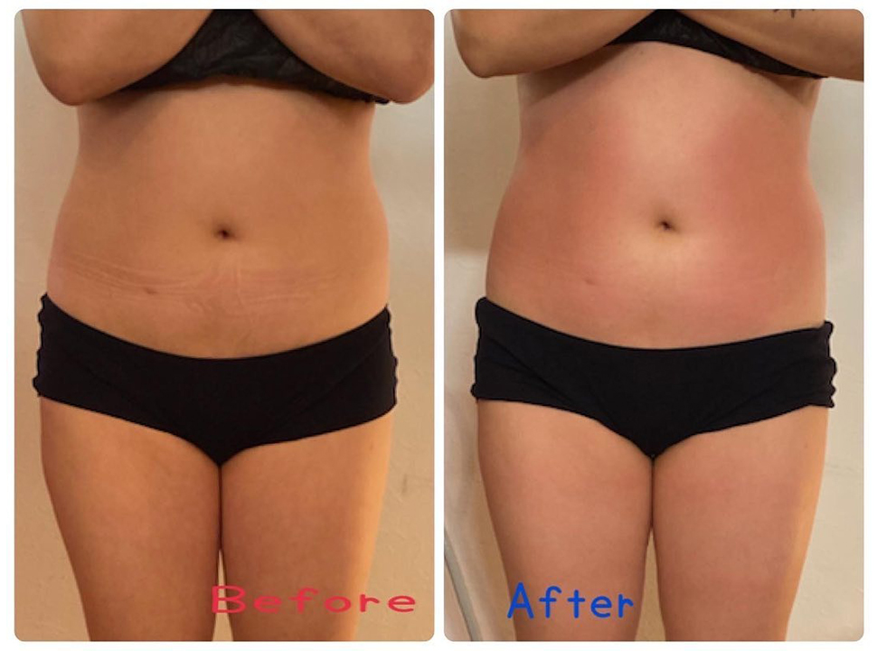 ウルトランスフォーマー